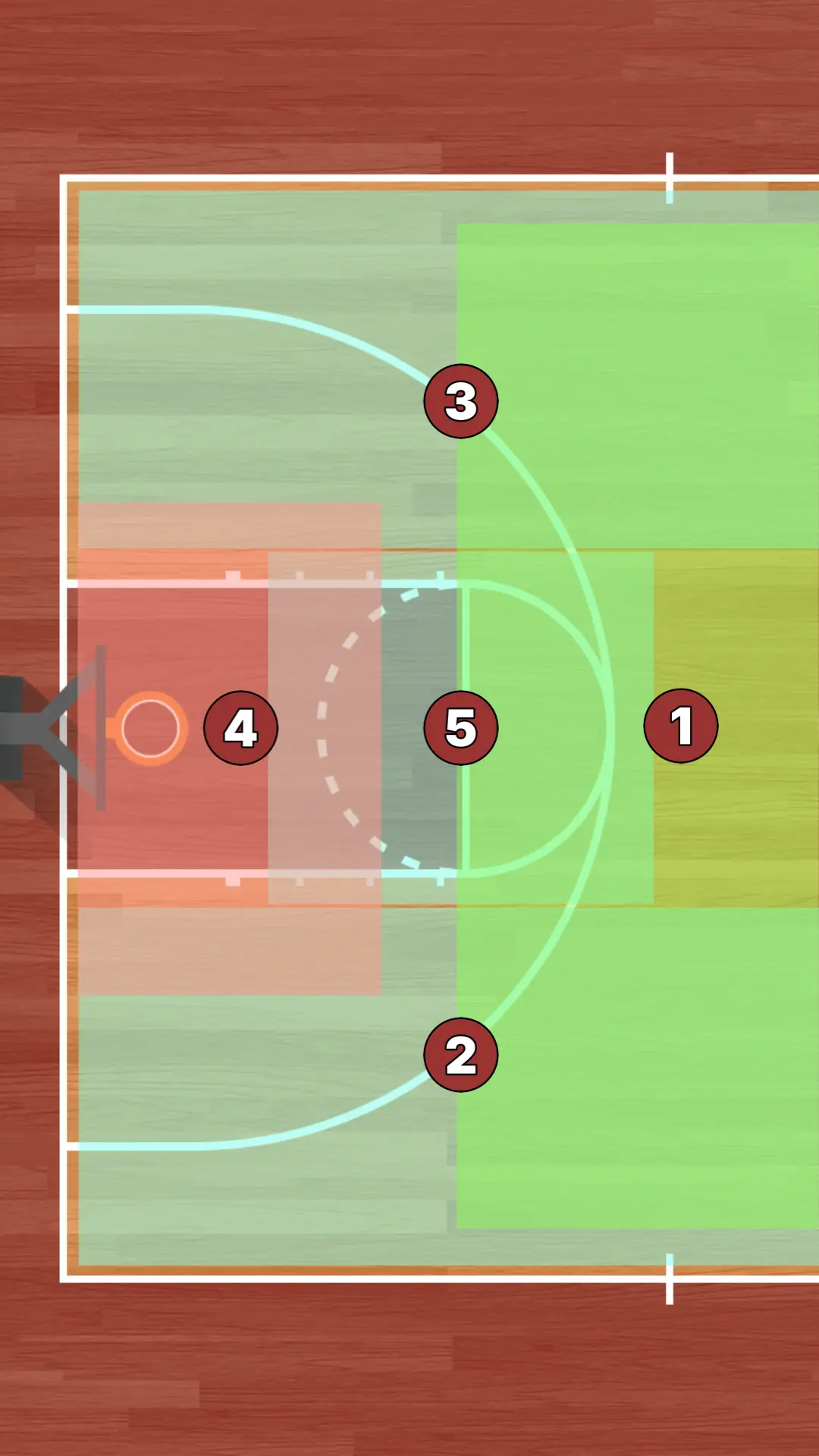 1-3-1 High Post preview